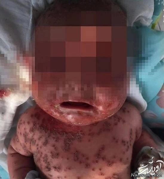 ابراز محبت به نوزاد